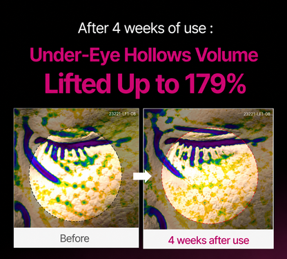 Leanhope Korean Calcium Dark Spot Eye Cream